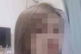 Người phụ nữ mặt trắng bệnh, co giật rồi chết não khi cấy ghép mỡ để làm đẹp