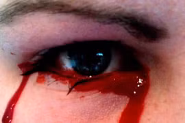 Rùng rợn những người khóc ra máu