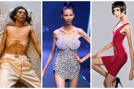 Phát hoảng thân hình gầy trơ xương của Thuận Nguyễn và loạt sao Việt