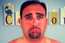 Chết cười với những vết cháy nắng lạ