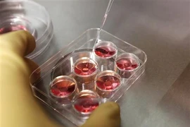 Chứng kiến quy trình đông lạnh trứng của chị em