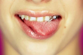 Những thói quen xấu phá hỏng hàm răng