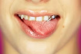 Những thói quen xấu phá hỏng hàm răng