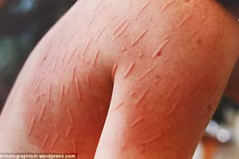 Rùng mình với trò điêu khắc trên da người