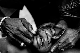 Hãi hùng nghi lễ rạch mặt tứa máu