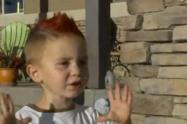 Thuốc lá điện tử phát nổ bé 3 tuổi bỏng nặng