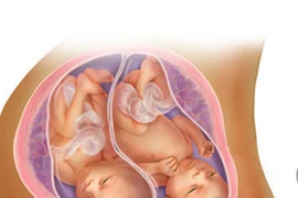 Ngắm thai đôi phát triển trong bụng mẹ