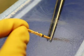 Đổ xô làm đông lạnh trứng để sinh con muộn