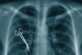 Những sơ suất y tế không thể chấp nhận được