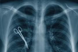 Những sơ suất y tế không thể chấp nhận được