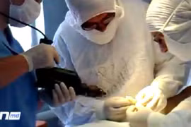 Bác sĩ mổ cho bệnh nhân bằng... máy khoan tường