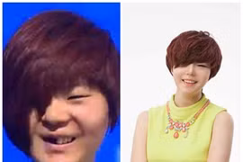 “Vịt bầu” hóa “thiên nga” nhờ 40 lần phẫu thuật thẩm mỹ