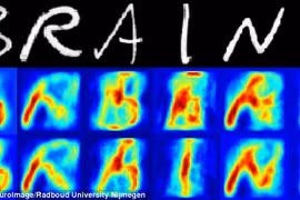 Sắp đọc được suy nghĩ bằng cách chụp não