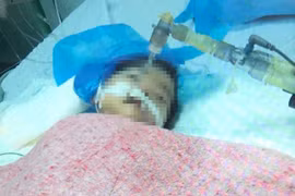 Video: Bị tiêm nhầm thuốc để uống, bé 8 tháng nguy kịch