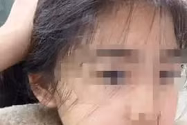 Nữ sinh bị chấn thương sọ não sau 2 tháng ở trường huấn luyện