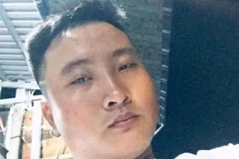 Người cha đổ nước sôi lên con ruột 6 tuổi khiến đứa bé bỏng nặng