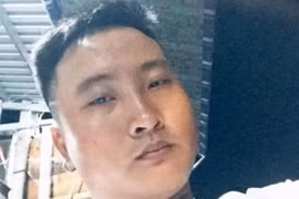 Người cha đổ nước sôi lên con ruột 6 tuổi khiến đứa bé bỏng nặng