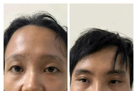 Chân dung cặp vợ chồng bạo hành bé trai 6 tuổi bằng nước sôi