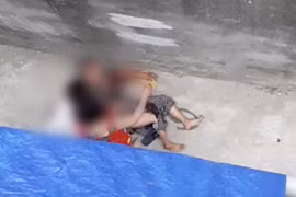 Đến thăm cháu, bà ngoại bị chó nhà nổi điên cắn nhập viện