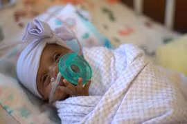 Sức sống phi thường của em bé nhỏ nhất thế giới