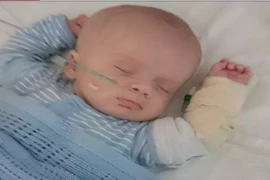 Bé trai 9 tuần tuổi chảy máu não do cha thường xuyên rung lắc