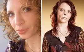 Chuyện tình ngọt ngào của cô gái không có mũi và môi