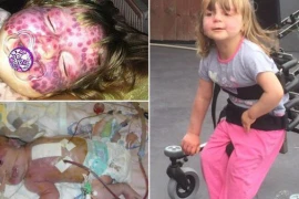 Thương tâm em bé xinh đẹp đầy vết chàm tím trên mặt