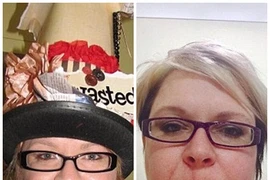 Kỳ lạ loại ung thư xúc hiếm gặp lan toàn cơ thể