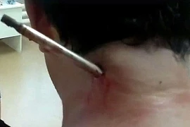 Sống sót kỳ diệu dù bị phi tiêu xuyên thẳng qua cổ