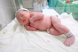 Bé gái chào đời cùng vòng tránh thai của mẹ