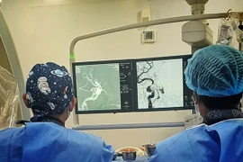 Ù tai, đỏ mắt không ngờ rò động mạch cảnh xoang hang sau tai nạn