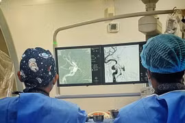 Ù tai, đỏ mắt không ngờ rò động mạch cảnh xoang hang sau tai nạn