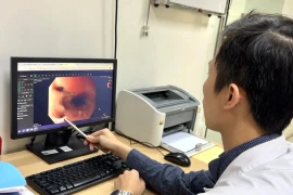 Đang chơi đùa, bé gái 11 tuổi bị chó nhà cắn thủng thực quản