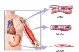 Cẩn thận biến chứng tiêu cơ vân sau chấn thương có thể gây suy đa tạng