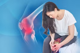 Nhiều người trẻ thoái hóa khớp gối biến chứng nguy hiểm