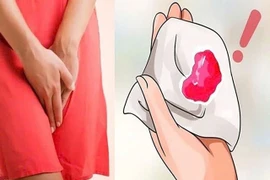 Ra máu sau 7 năm mãn kinh, người phụ nữ 55 tuổi phát hiện ung thư niêm mạc tử cung - Ảnh minh họa 