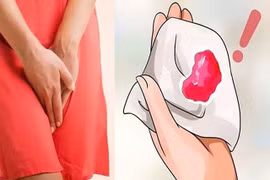 Ra máu sau 7 năm mãn kinh, người phụ nữ 55 tuổi phát hiện ung thư niêm mạc tử cung - Ảnh minh họa 