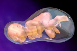 Sản phụ mất con do cạn ối sinh non: Ối cạn, cách nào dưỡng, giữ thai?