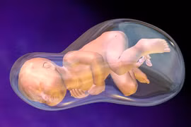 Sản phụ mất con do cạn ối sinh non: Ối cạn, cách nào dưỡng, giữ thai?