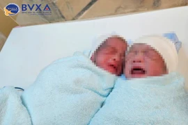Hy hữu: cặp song sinh mắc hội chứng truyền máu song thai ra đời khỏe mạnh