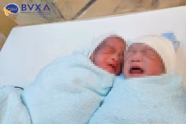 Hy hữu: cặp song sinh mắc hội chứng truyền máu song thai ra đời khỏe mạnh