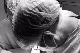 Đau tức nhẹ khi vận động cánh tay không ngờ u xương sườn lớn hiếm gặp