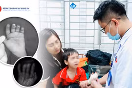 Nghịch dao, trẻ bị đứt lìa nhiều đốt ngón tay