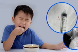 Trẻ 16 tháng tuổi hóc xương cá nguy hiểm vào đường thở, cách gì phòng tránh?