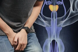 Không đau nhưng cắt bỏ cả 2 tinh hoàn vì ung thư