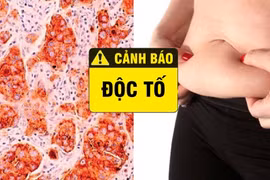 Dấu hiệu cho thấy cơ thể cần thải độc tố