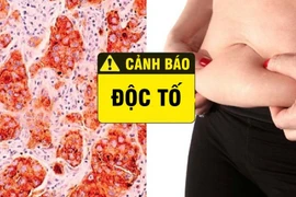 Dấu hiệu cho thấy cơ thể cần thải độc tố