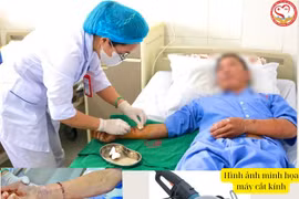 Cơn ác mộng của người đàn ông 2 lần bị lưỡi cưa cắt "đứt" tay