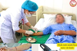 Cơn ác mộng của người đàn ông 2 lần bị lưỡi cưa cắt "đứt" tay