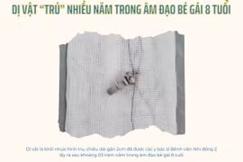 Hy hữu: Dị vật “trú” nhiều năm trong âm đạo bé gái 8 tuổi